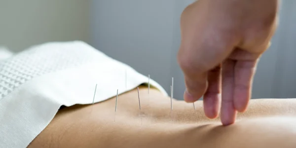acupuncture stock 2